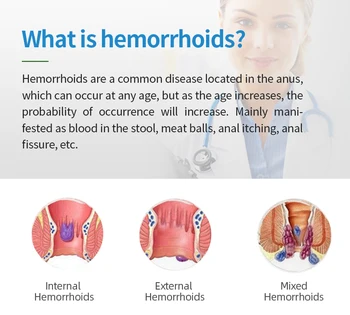 Hemorrhoid Medicinos Kremas Išangės Įtrūkimai Šaltas Kompresas Gelio Išorės Hemorojus Šalinimo Plug Malšinantis Gydymas, Tepalas