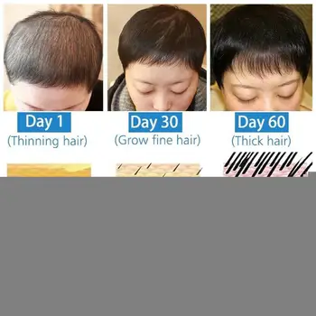 1Pcs 20ml arbatmedžio Maitinamasis Plaukų Augimo Esmė Gydymo Nuostolių Aliejus Plaukų, Kad Priežiūros Aliejus Sklandžiau užkirsti Kelią Plaukų Anti - E1O2